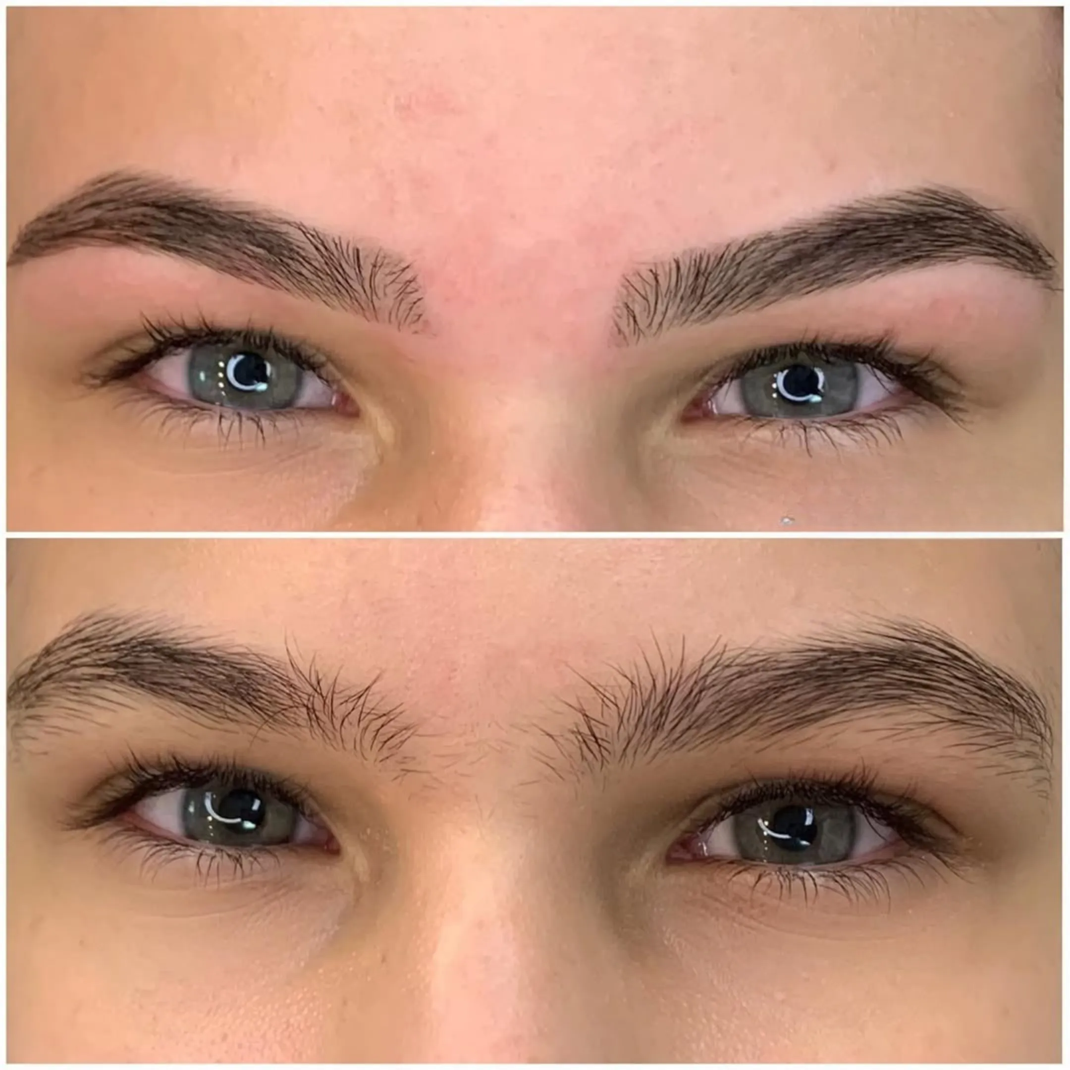 antes e depois de despigmentação de sobrancelha grossa