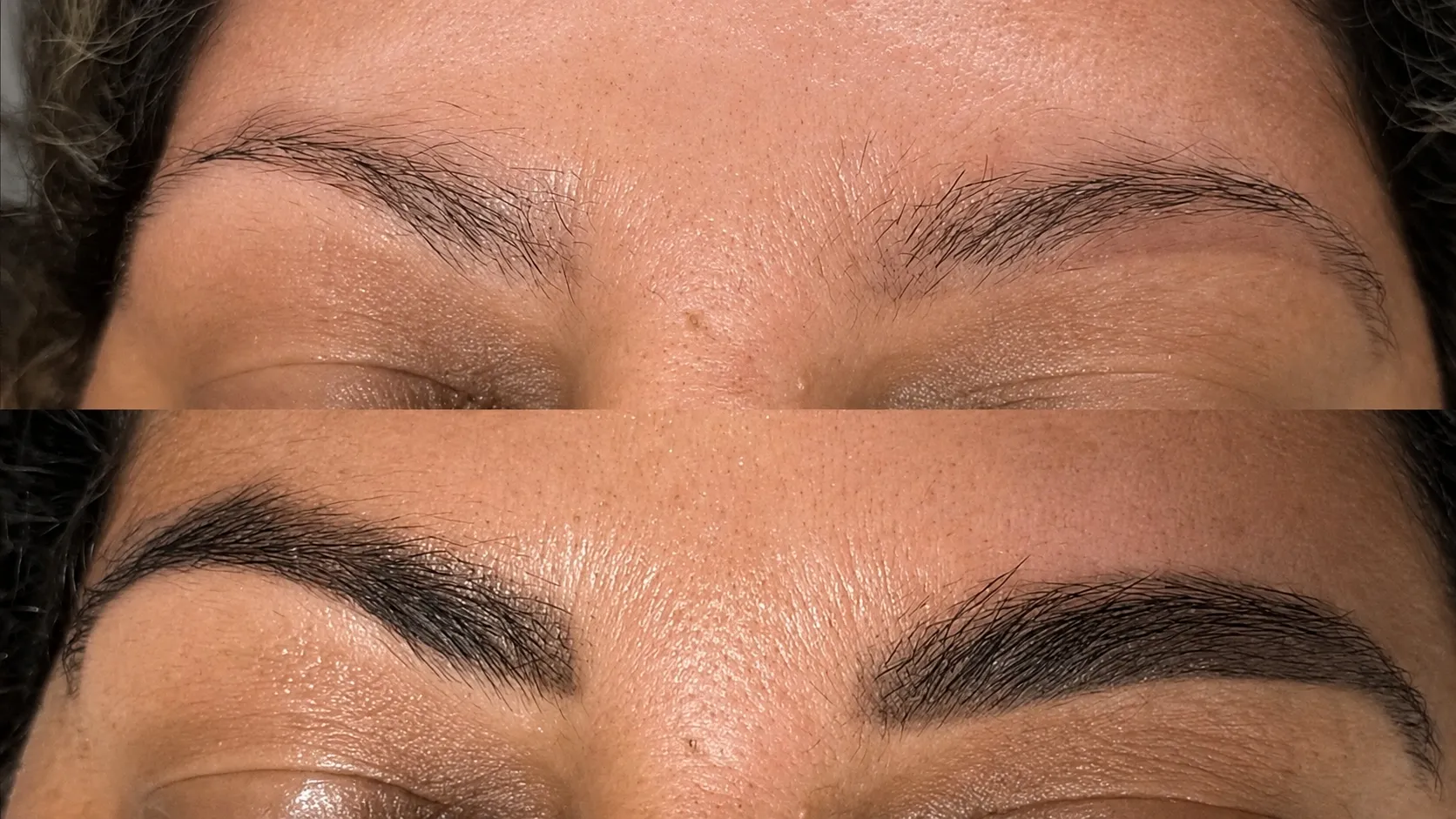 antes e depois de despigmentação de sobrancelha artificial
